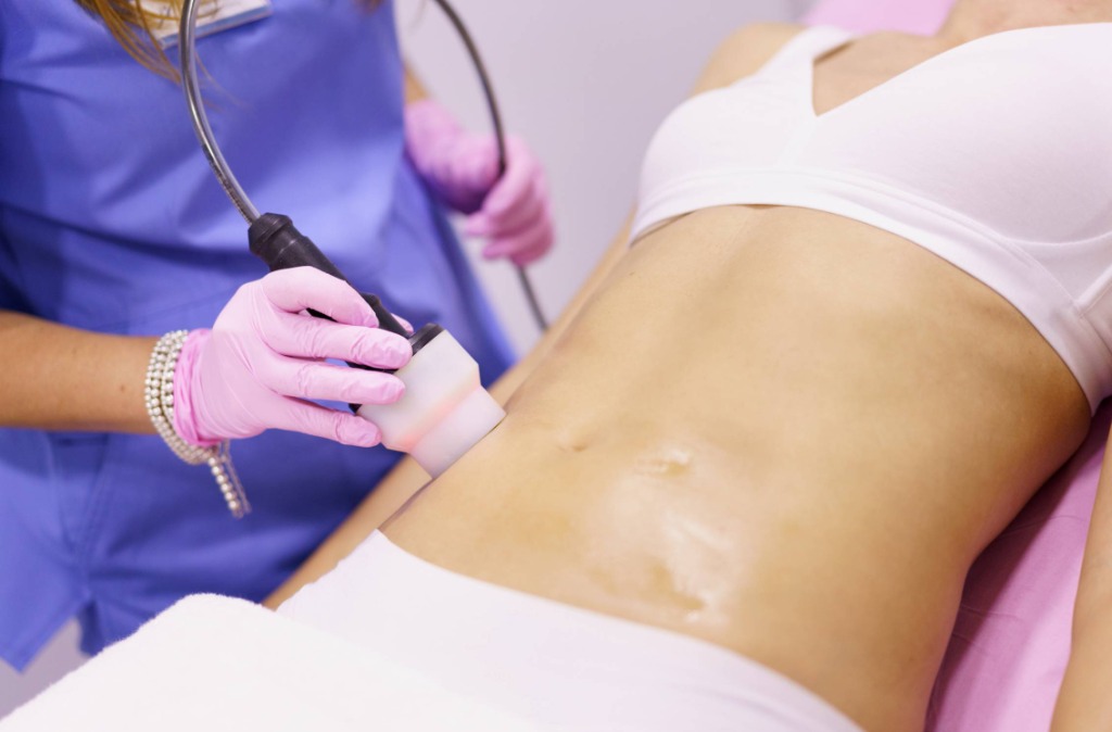 Lipocavitação: A lipo sem cortes