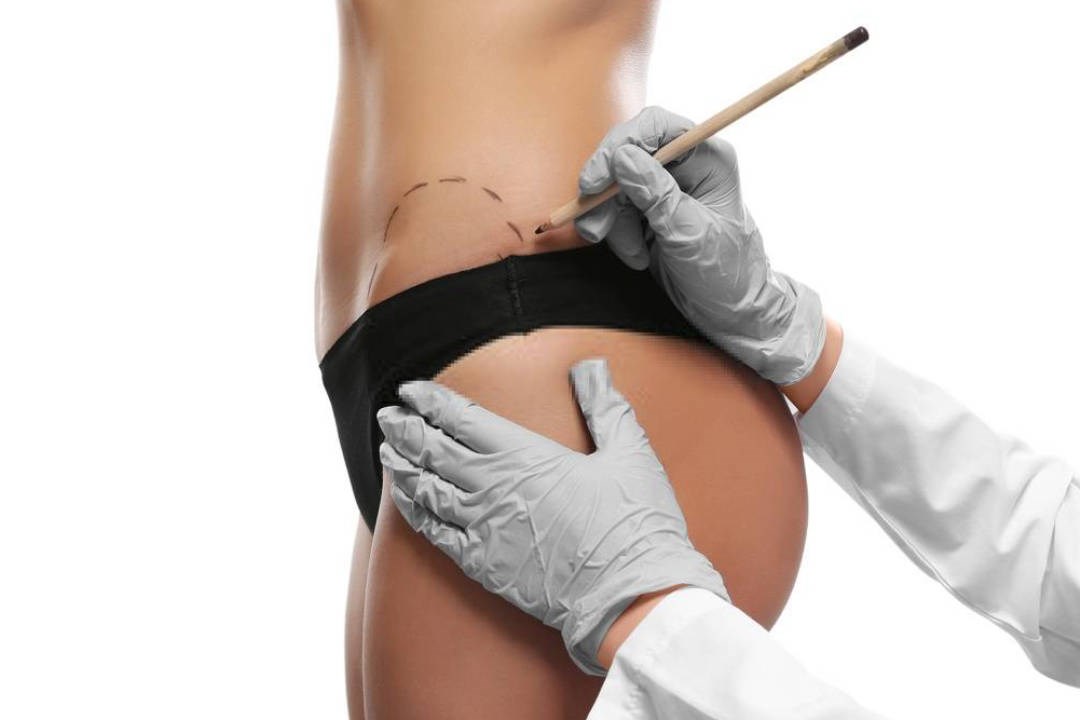 Aplicação de Enzimas para gordura localizada em Uberlândia