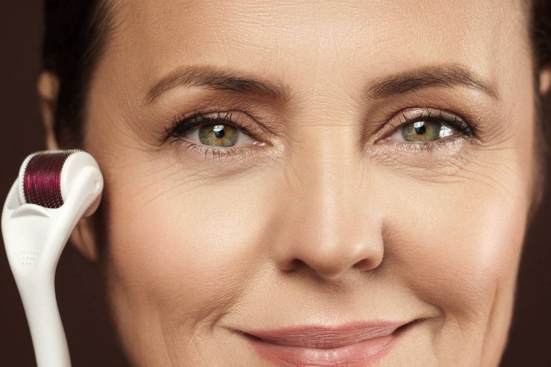 Tratamento de Microagulhamento em Uberlândia - NeoSkin